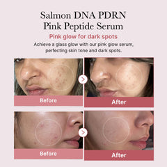 medicube Salmon DNA PDRN Pink Peptide Serum, 1.01 fl.oz