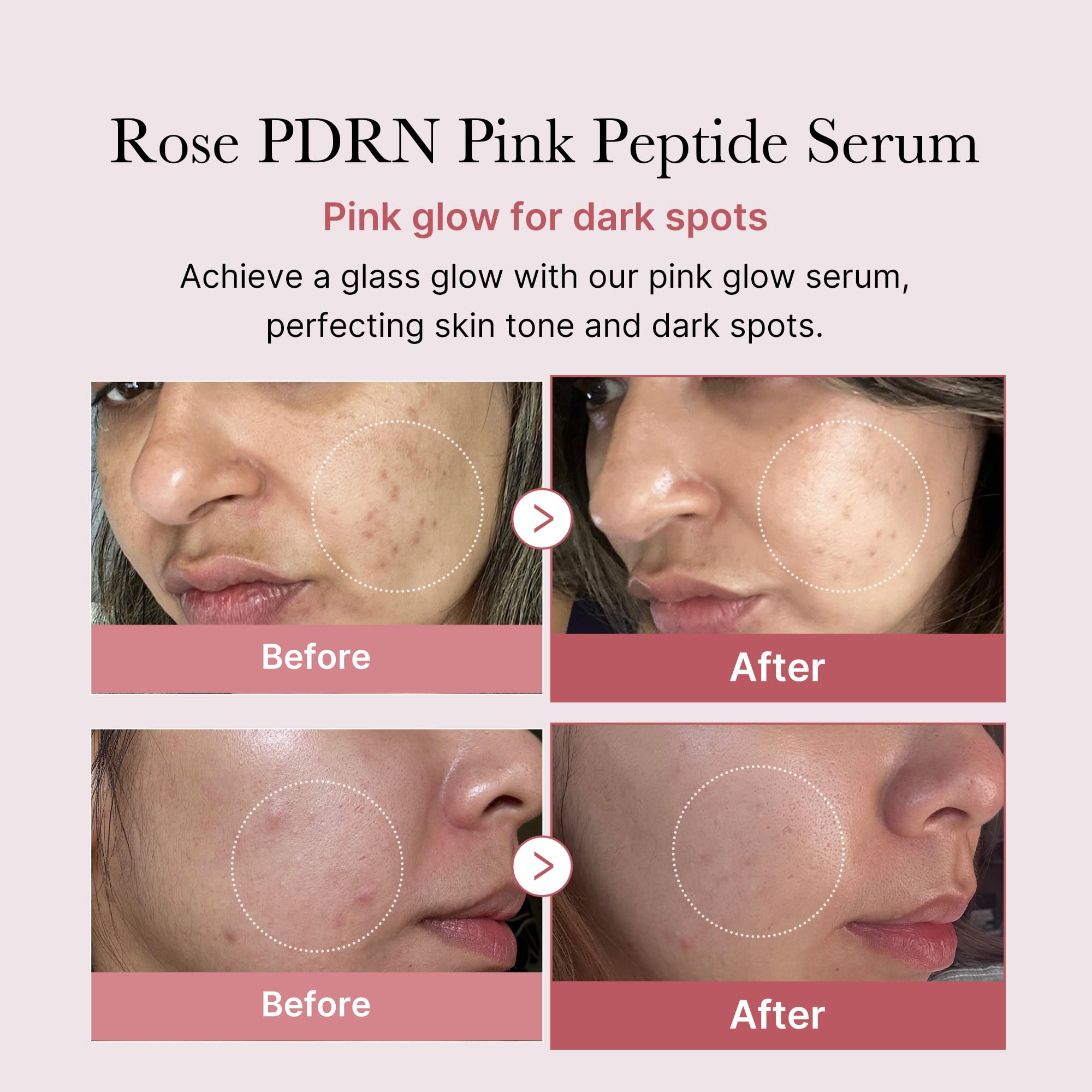 medicube Salmon DNA PDRN Pink Peptide Serum, 1.01 fl.oz